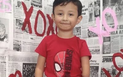 Piden apoyo para que Edgar pueda acceder a cirugía que mejorará su calidad de vida