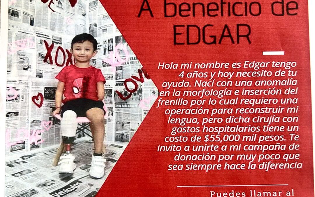 Buscan recaudar 55 mil pesos para cirugía que cambiaría la vida de Edgar